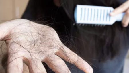 Tek bir şiddetli gerilim olayı, tekrarlayan saç dökülmesini tetikleyebilir
